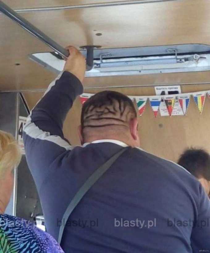 Kiedy tłuszcz na głowie przybiera kształt mózgu