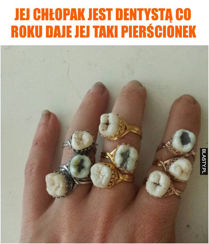 Jej chłopak jest dentystą co roku daje jej taki pierścionek
