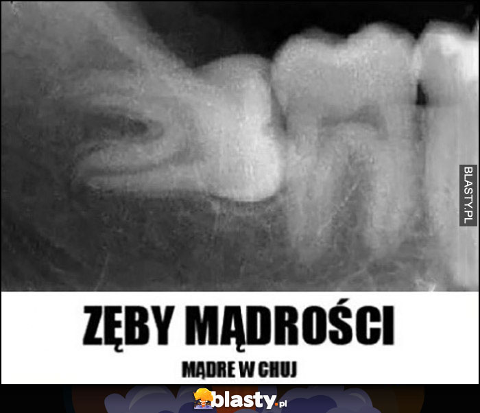 Zęby mądrości no mądre w opór, rośnie w bok