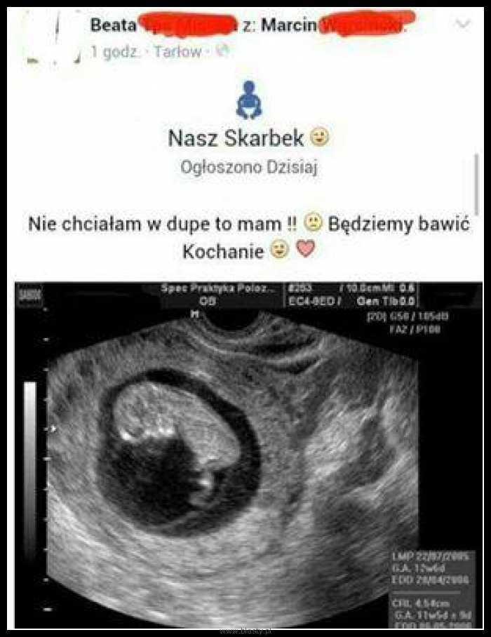 Czasem można też założyć gumę