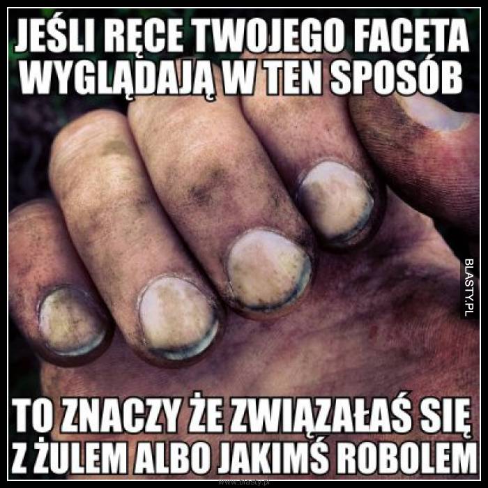 Jeśli ręce Twojego faceta wyglądają w ten sposób to znaczy, że związałaś się z żulem albo jakimś robolem