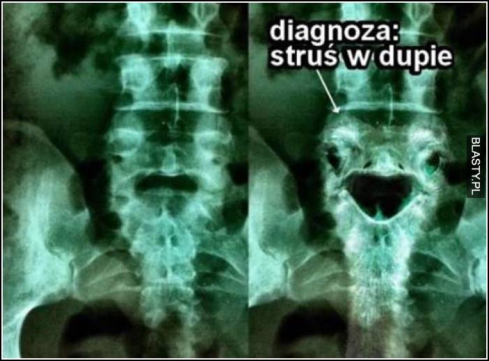 Diagnoza struś w dupie