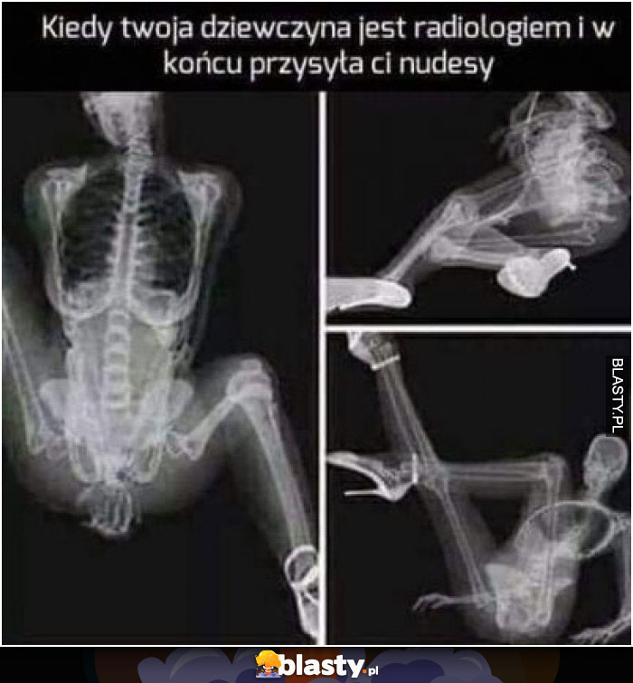 Kiedy twoja dziewczyna jest radiologiem