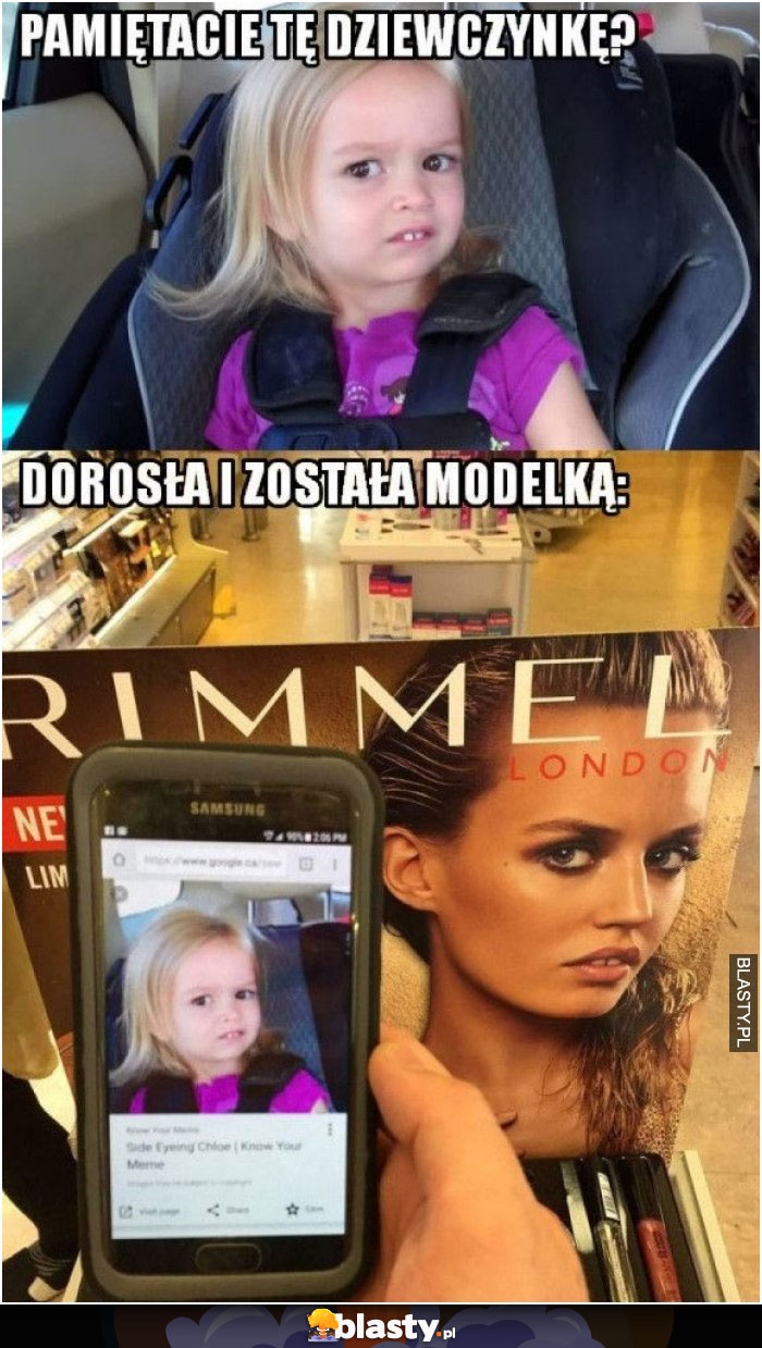 Dziewczynka ze śmiesznymi zębami dorosła i została modelką