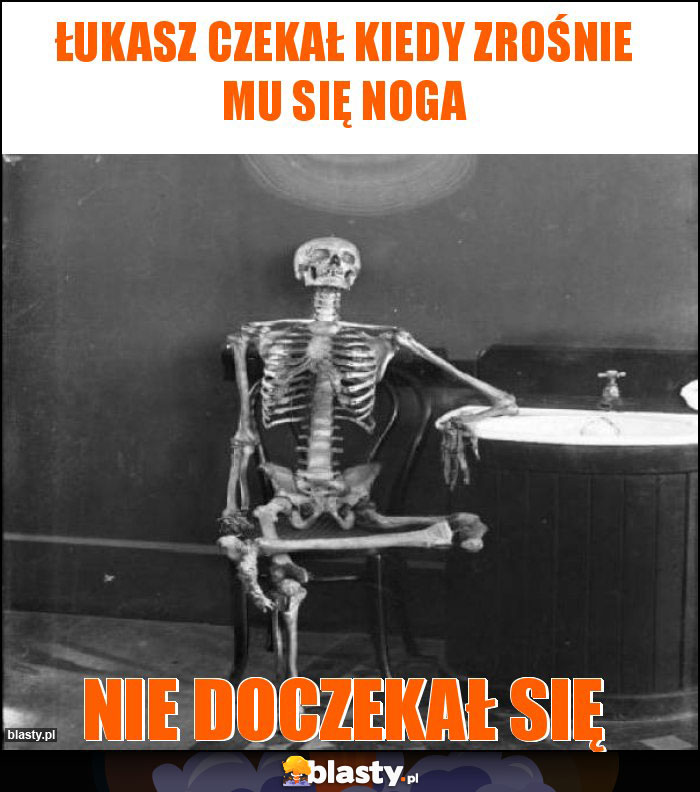 Łukasz czekał kiedy zrośnie mu się noga Łukasz czekał kiedy zrośnie mu się noga