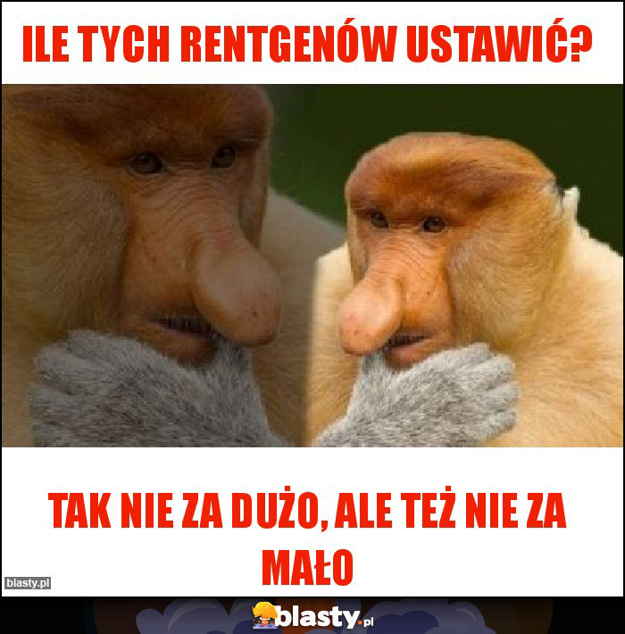 Ile tych rentgenów ustawić? Ile tych rentgenów ustawić?