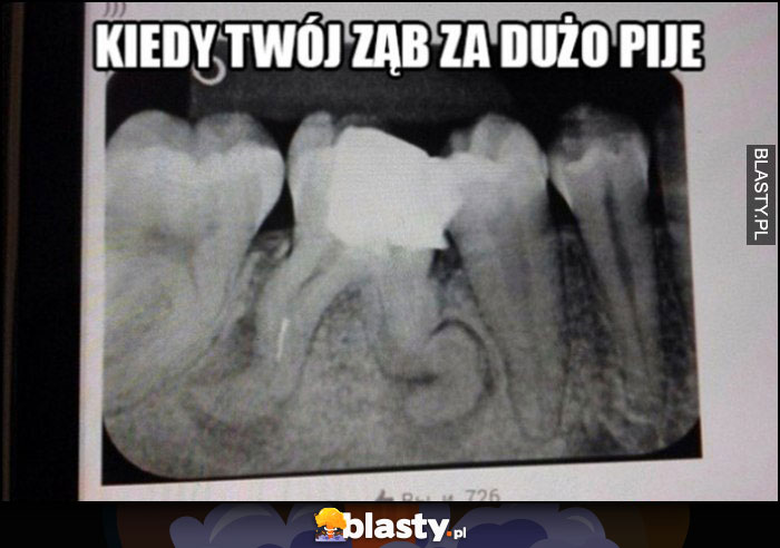 Kiedy Twój ząb za dużo pije pokrzywione korzenie jakby chodził