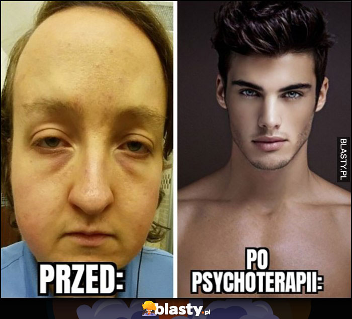 Przed vs po psychoterapii przegryw zmienia się w chada