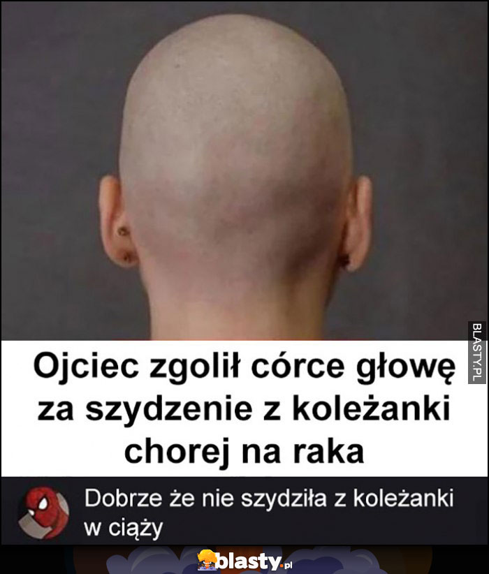 Ojciec zgolił córce głowę za szydzenie z koleżanki chorej na raka, dobrze że nie szydziła z koleżanki w ciąży